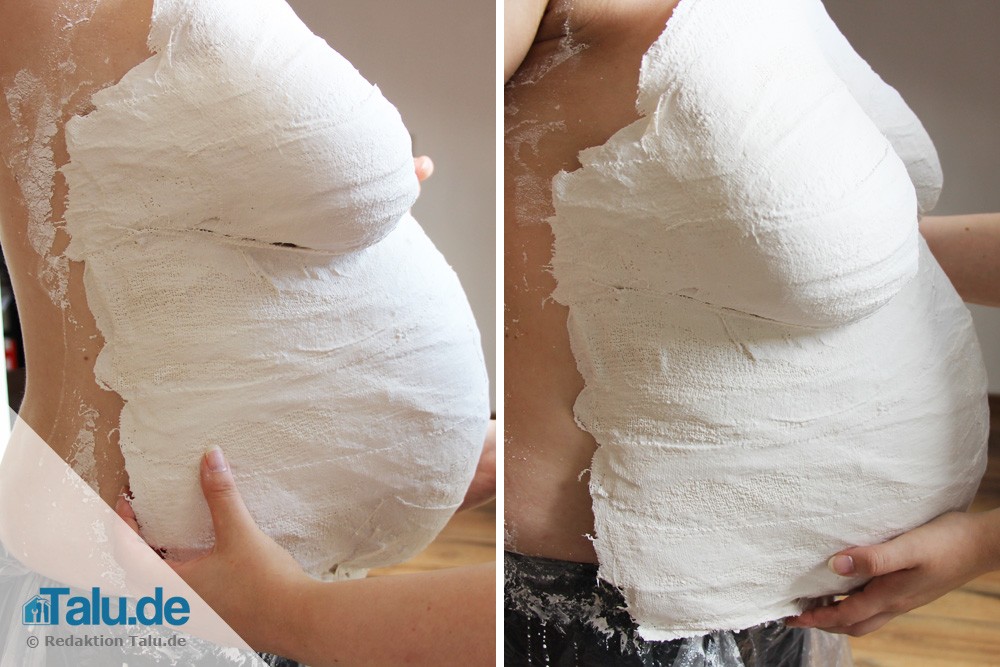 Babybauch: Gipsabdruck abnehmen
